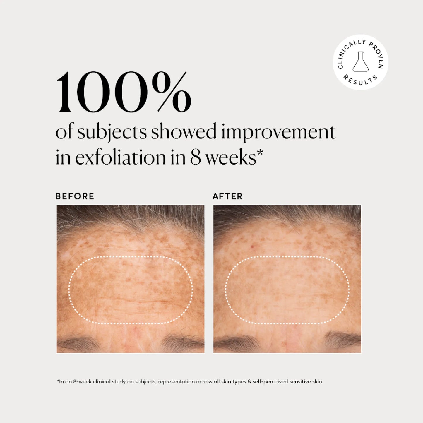 bha-liquid-exfoliant-2-q7 NATR-10027-Alt-Images-BHA-Liquid-Exfoliant-2_-03.webp